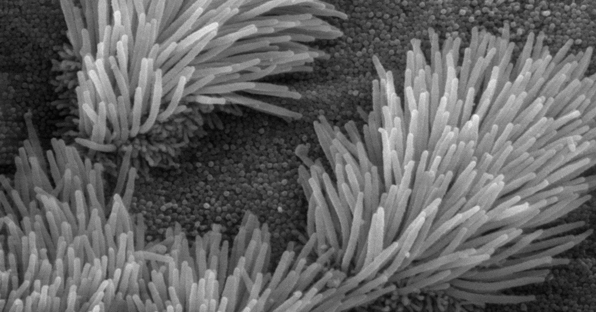 Transporte cilio e intraflagelar: más irreductiblemente complejo que nunca