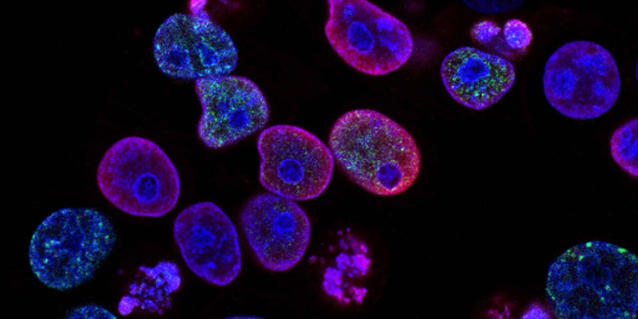 La tesis, la ‘Involución de Darwin’, aplicada en dos estudios sobre el cáncer